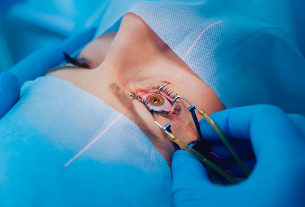 Woman undergoing LASIK eye surgery